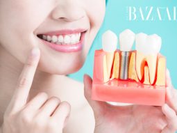 8 tác hại của việc trồng răng implant bạn không được chủ quan